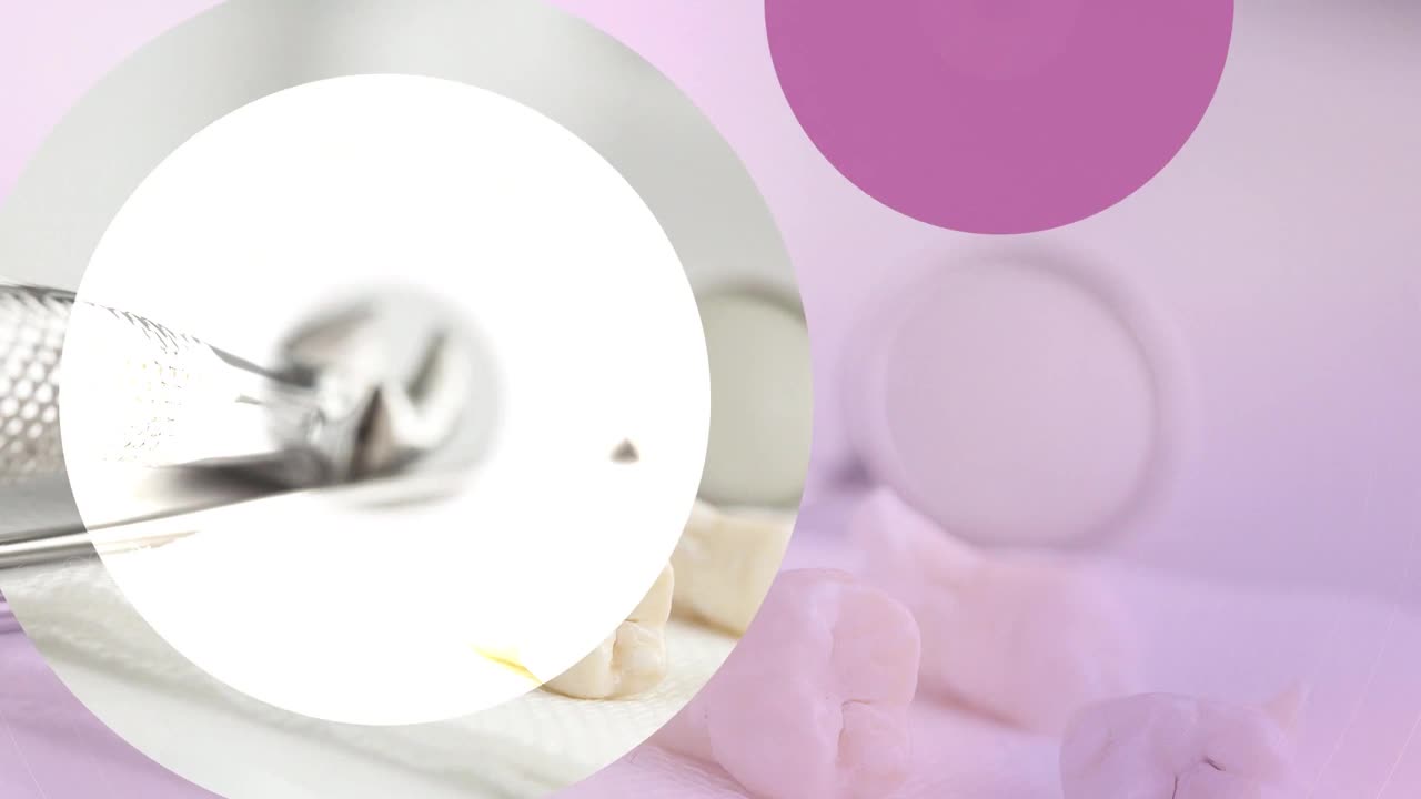 ASR / Approximale Schmelzreduktion