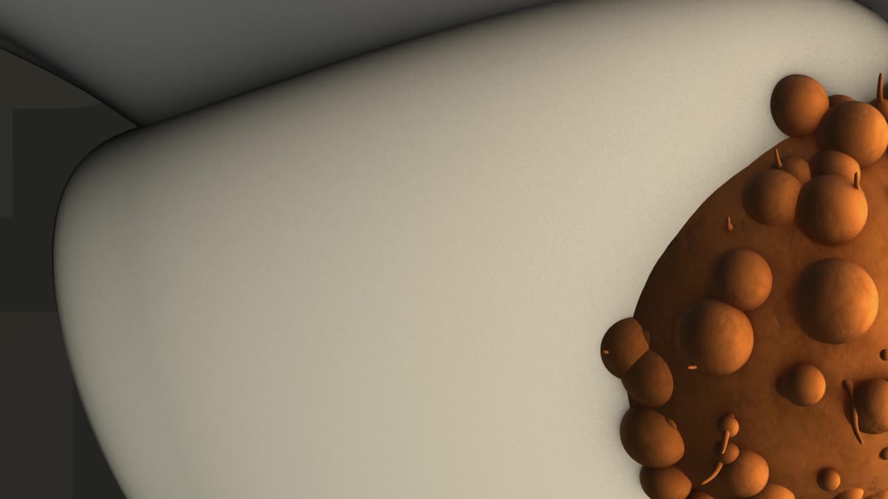 PSA-Test