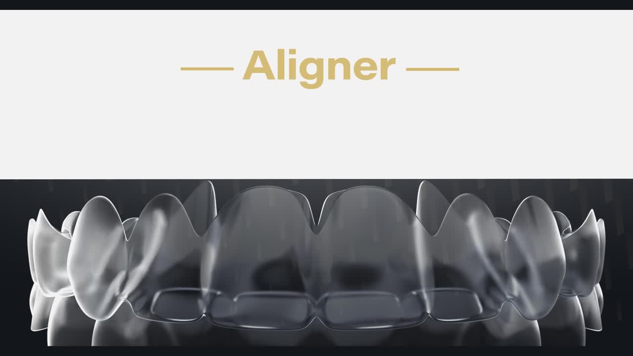 Aligner (Transparente Zahnschienen)