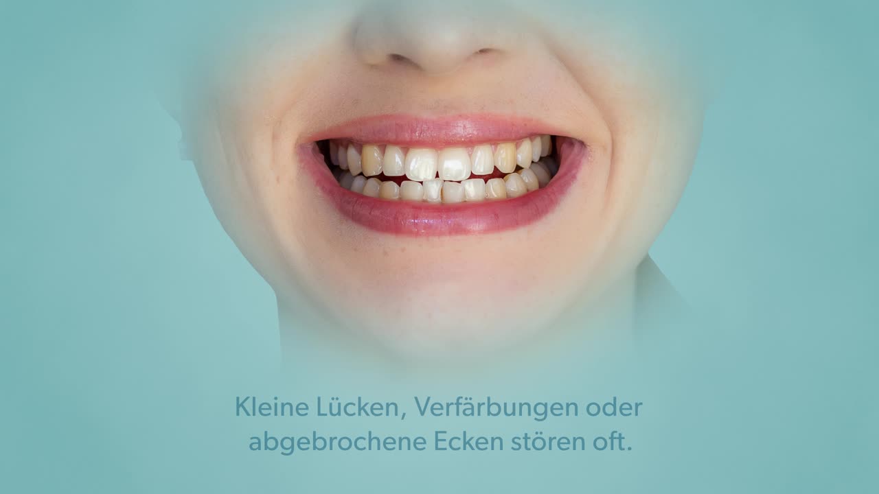 Ultradünne Keramikverblendungen