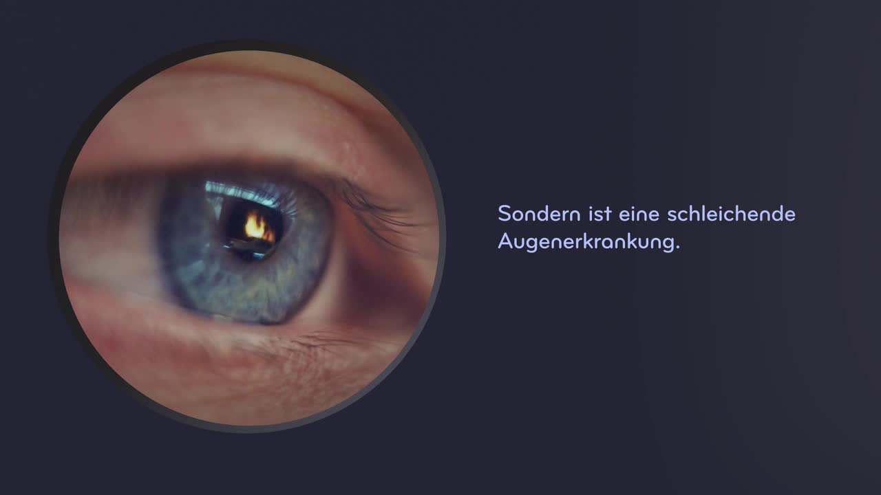 SLT / Selektive Laser-Trabekuloplastik bei Glaukom