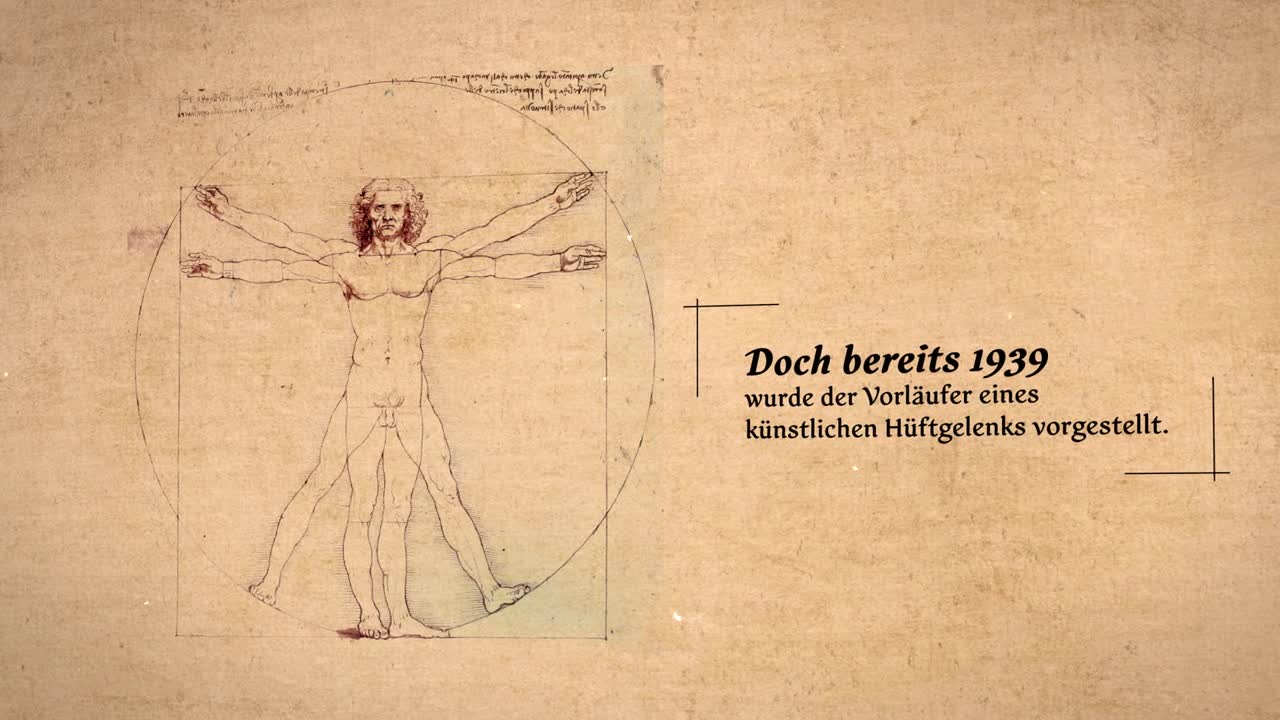 Endoprothetik (Allgemein)