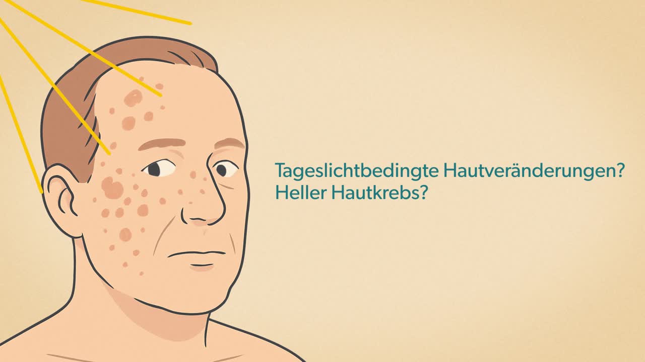 PDT / Photodynamische Therapie (Dermatologie)