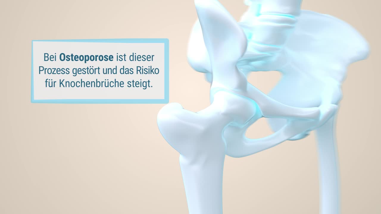 Knochendichtemessung (DXA-Verfahren)
